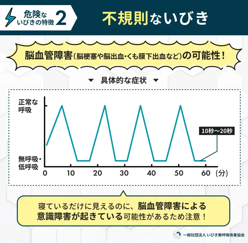不規則ないびき