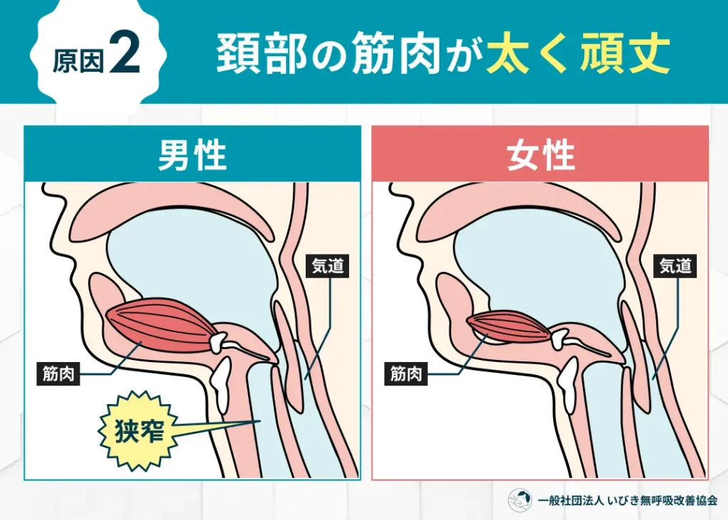 頚部の筋肉が太く頑丈