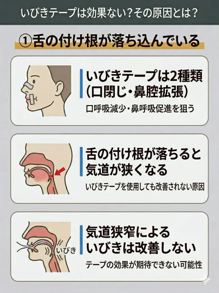 舌の付け根が落ち込んでいる