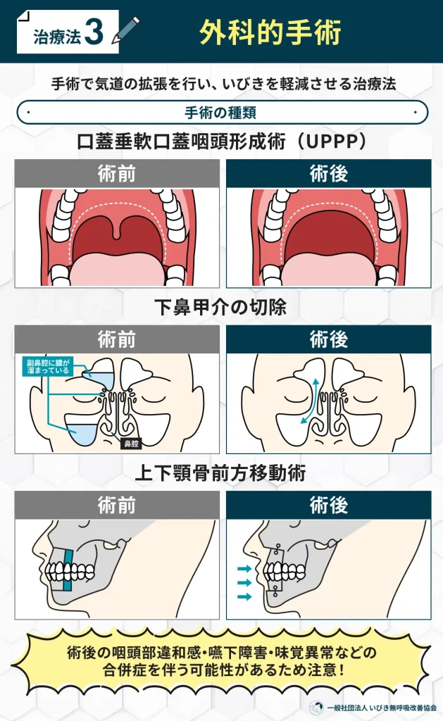 外科的手術